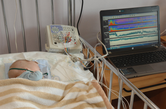 Klinika za dječje bolesti Zagreb